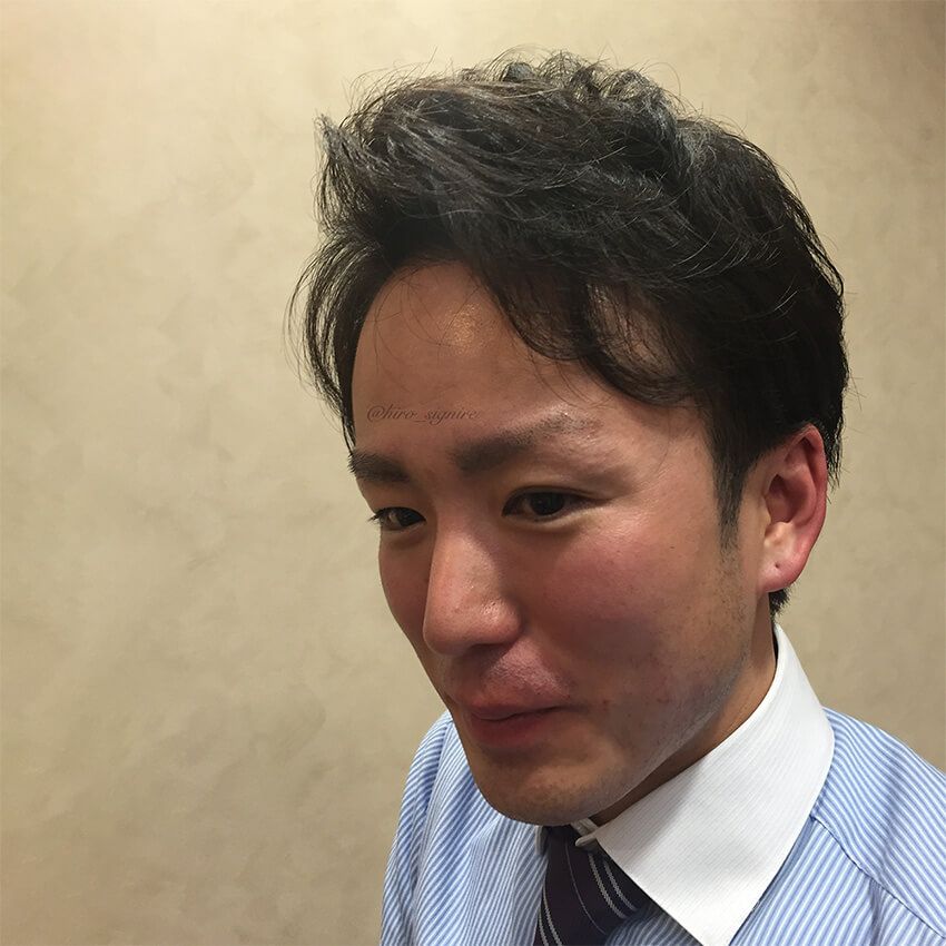 「ハゲと汚肌で鏡を見るのが嫌だった」38歳美容家・ヒロキのアンチエイジング体験記 - 4枚目の画像