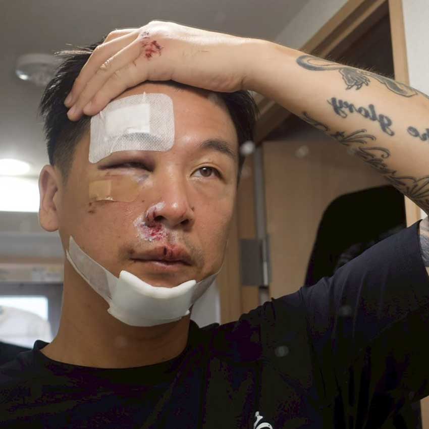 死んだと思った」事故から奇跡の復活。オリンピック強化指定選手に決定