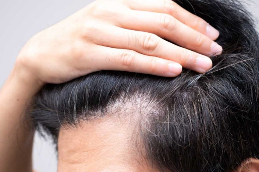 ガムの咀嚼が“薄毛予防”の救世主に!? ロッテ研究部員にその真相を探ってみた！ - 3枚目の画像