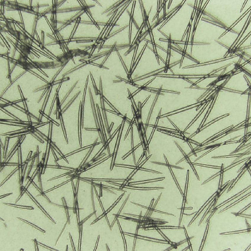 「痛い美容液」が韓国で爆発的ヒット中！ 美容先進国をトリコにした“針”の正体 - 1枚目の画像