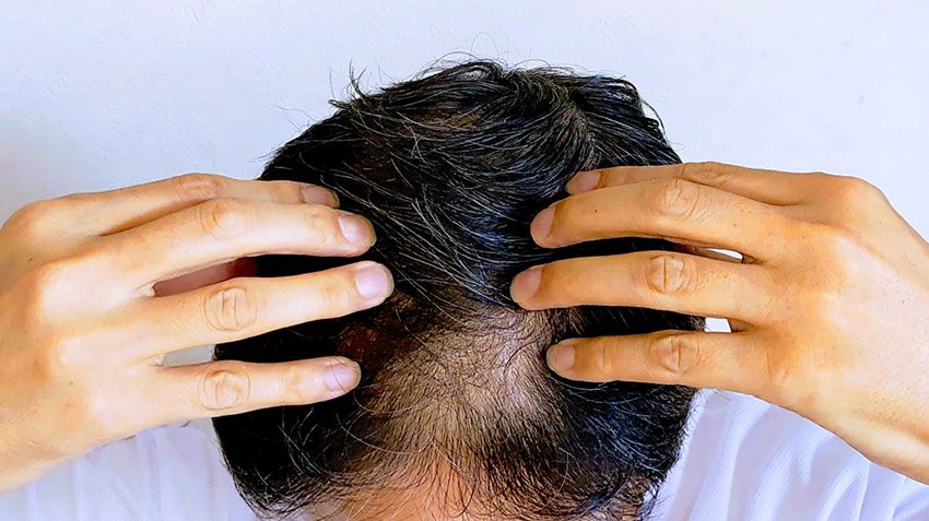 「いつも同じ分け目の髪型」も要注意！40℃以上の酷暑日は“頭皮”が危険。毛髪診断士が推すヘアケア術 - 2枚目の画像