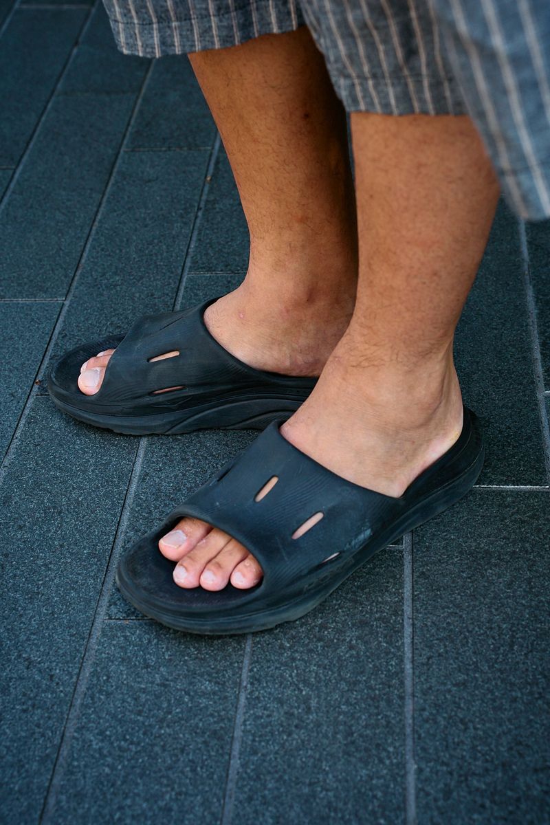 オーバーTの選び方。肘を覆う丈がしっくり 細野大介 7枚目の写真